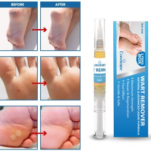 Conotrane Verruca Remover – 2 Pen Extra Strong Treatment Freeze – Foot & Hand Wart Plantar Corn Strong Remover – 2021 Natural & Safe Remover- Convenient &Compact Kits.